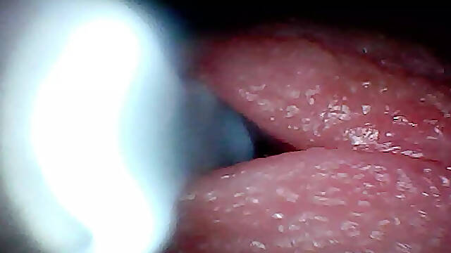 Endoscope camera captures moment of male ejaculation